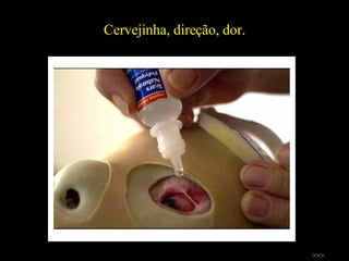 Cervejinha, direção, dor. >>> 