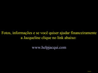 Fotos, informações e se você quiser ajudar financeiramente a Jacqueline clique no link abaixo:  www. helpjacqui .com >>> 