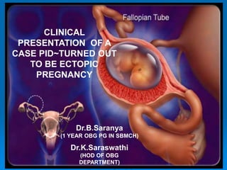 CLINICAL
PRESENTATION OF A
CASE PID~TURNED OUT
TO BE ECTOPIC
PREGNANCY
Dr.B.Saranya
(1 YEAR OBG PG IN SBMCH)
Dr.K.Saraswathi
(HOD OF OBG
DEPARTMENT)
 