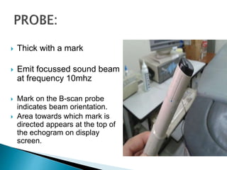  Thick with a mark
 Emit focussed sound beam
at frequency 10mhz
 Mark on the B-scan probe
indicates beam orientation.
 Area towards which mark is
directed appears at the top of
the echogram on display
screen.
 