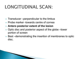  Transducer –perpendicular to the limbus
 Probe marker -towards centre of cornea
 Antero posterior extent of the lesion
 Optic disc and posterior aspect of the globe –lower
portion of screen
 Best –demonstrating the insertion of membranes to optic
disc.
 