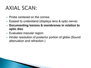  Probe centered on the cornea
 Easiest to understand (displays lens & optic nerve)
 Documenting lesions & membranes in relation to
optic disc
 Evaluates macular region
 Hinder resolution of posterior portion of globe (Sound
attenuation and refraction )
 