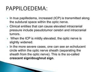  In true papilledema, increased (ICP) is transmitted along
the subdural space within the optic nerve.
 Clinical entities that can cause elevated intracranial
pressure include pseudotumor cerebri and intracranial
tumors.
 When the ICP is mildly elevated, the optic nerve is
slightly widened.
 In the more severe cases, one can see an echolucent
circle within the optic nerve sheath (separating the
sheath from the optic nerve). This is the so-called
crescent sign/doughnut sign.
 