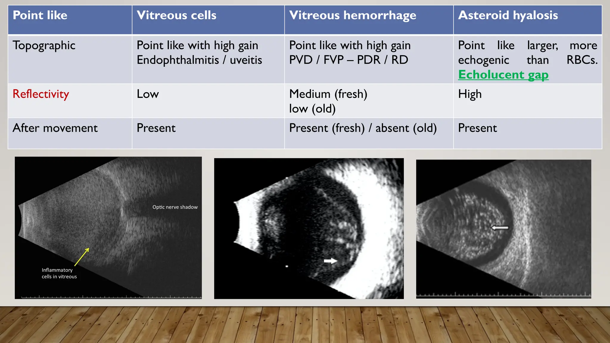Point like Vitreous cells Vitreous hemorrhage Asteroid hyalosis
Topographic Point like with high gain
Endophthalmitis / uveitis
Point like with high gain
PVD / FVP – PDR / RD
Point like larger, more
echogenic than RBCs.
Echolucent gap
Reflectivity Low Medium (fresh)
low (old)
High
After movement Present Present (fresh) / absent (old) Present
 