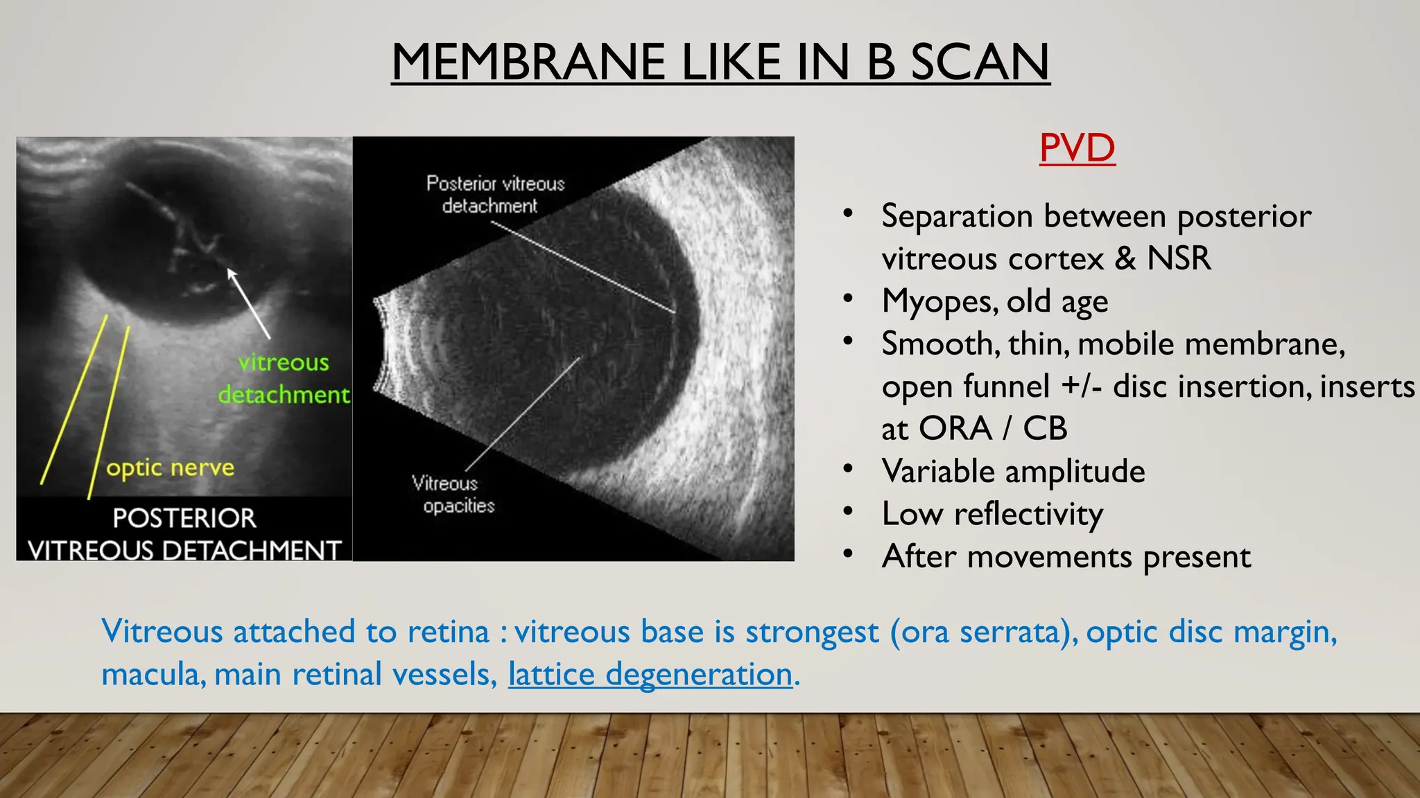 MEMBRANE LIKE IN B SCAN
PVD
• Separation between posterior
vitreous cortex & NSR
• Myopes, old age
• Smooth, thin, mobile membrane,
open funnel +/- disc insertion, inserts
at ORA / CB
• Variable amplitude
• Low reflectivity
• After movements present
Vitreous attached to retina : vitreous base is strongest (ora serrata), optic disc margin,
macula, main retinal vessels, lattice degeneration.
 
