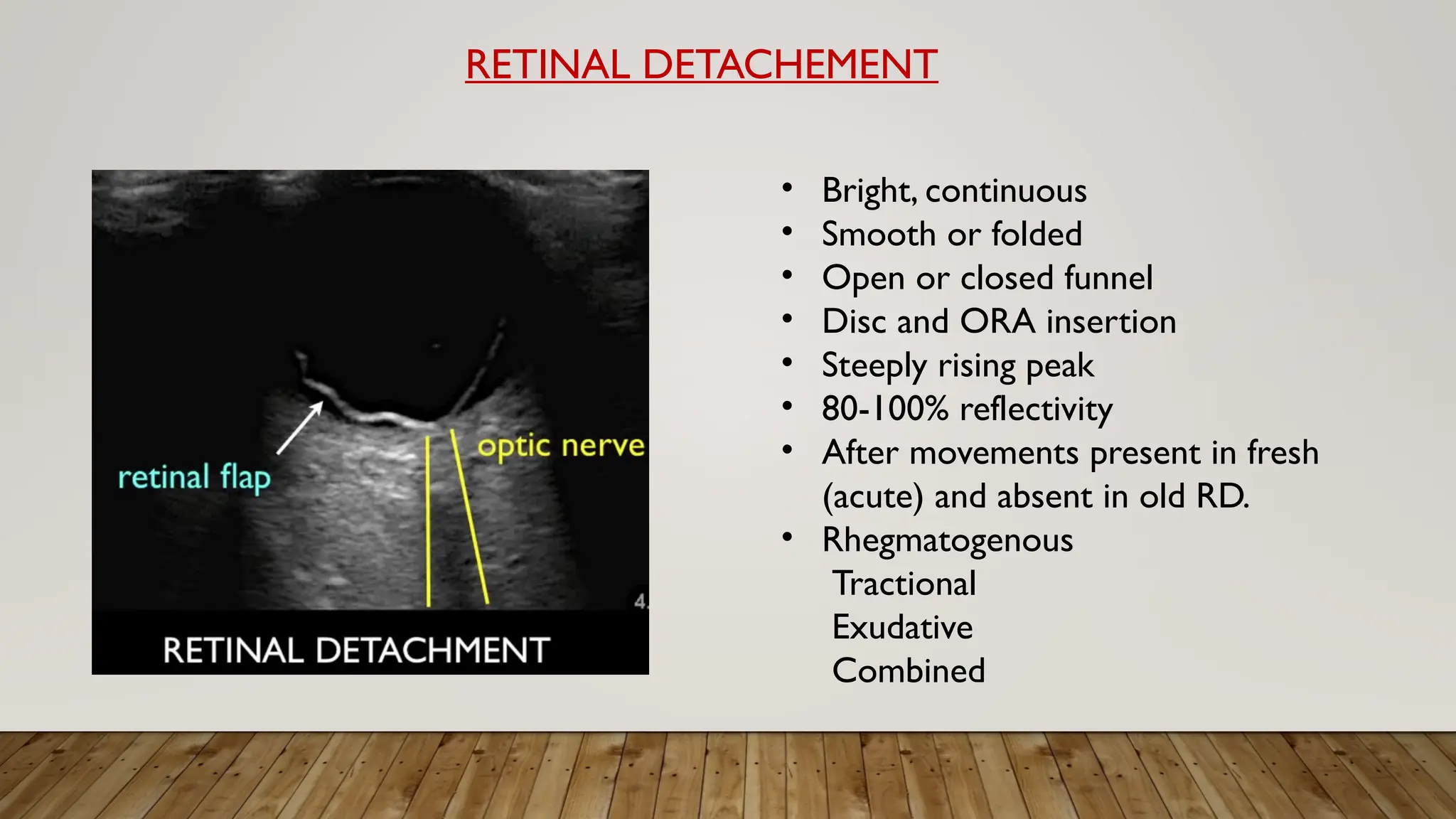 RETINAL DETACHEMENT
• Bright, continuous
• Smooth or folded
• Open or closed funnel
• Disc and ORA insertion
• Steeply rising peak
• 80-100% reflectivity
• After movements present in fresh
(acute) and absent in old RD.
• Rhegmatogenous
Tractional
Exudative
Combined
 