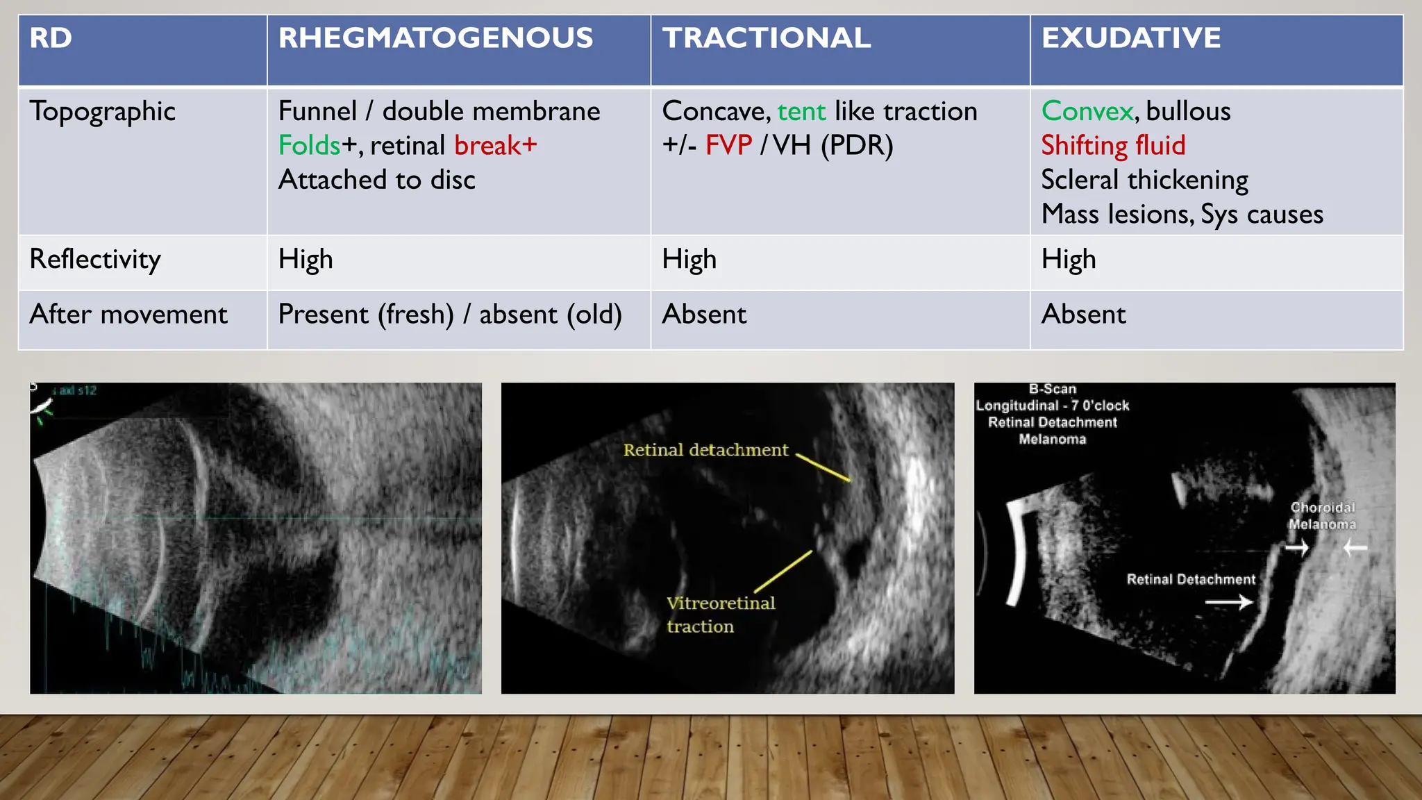 RD RHEGMATOGENOUS TRACTIONAL EXUDATIVE
Topographic Funnel / double membrane
Folds+, retinal break+
Attached to disc
Concave, tent like traction
+/- FVP /VH (PDR)
Convex, bullous
Shifting fluid
Scleral thickening
Mass lesions, Sys causes
Reflectivity High High High
After movement Present (fresh) / absent (old) Absent Absent
 