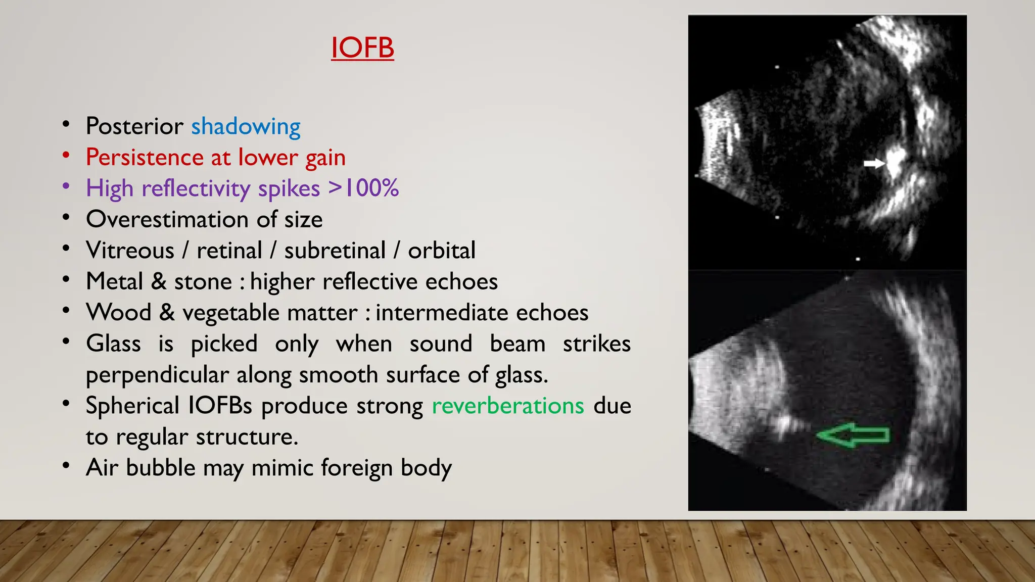 • Posterior shadowing
• Persistence at lower gain
• High reflectivity spikes >100%
• Overestimation of size
• Vitreous / retinal / subretinal / orbital
• Metal & stone : higher reflective echoes
• Wood & vegetable matter : intermediate echoes
• Glass is picked only when sound beam strikes
perpendicular along smooth surface of glass.
• Spherical IOFBs produce strong reverberations due
to regular structure.
• Air bubble may mimic foreign body
IOFB
 