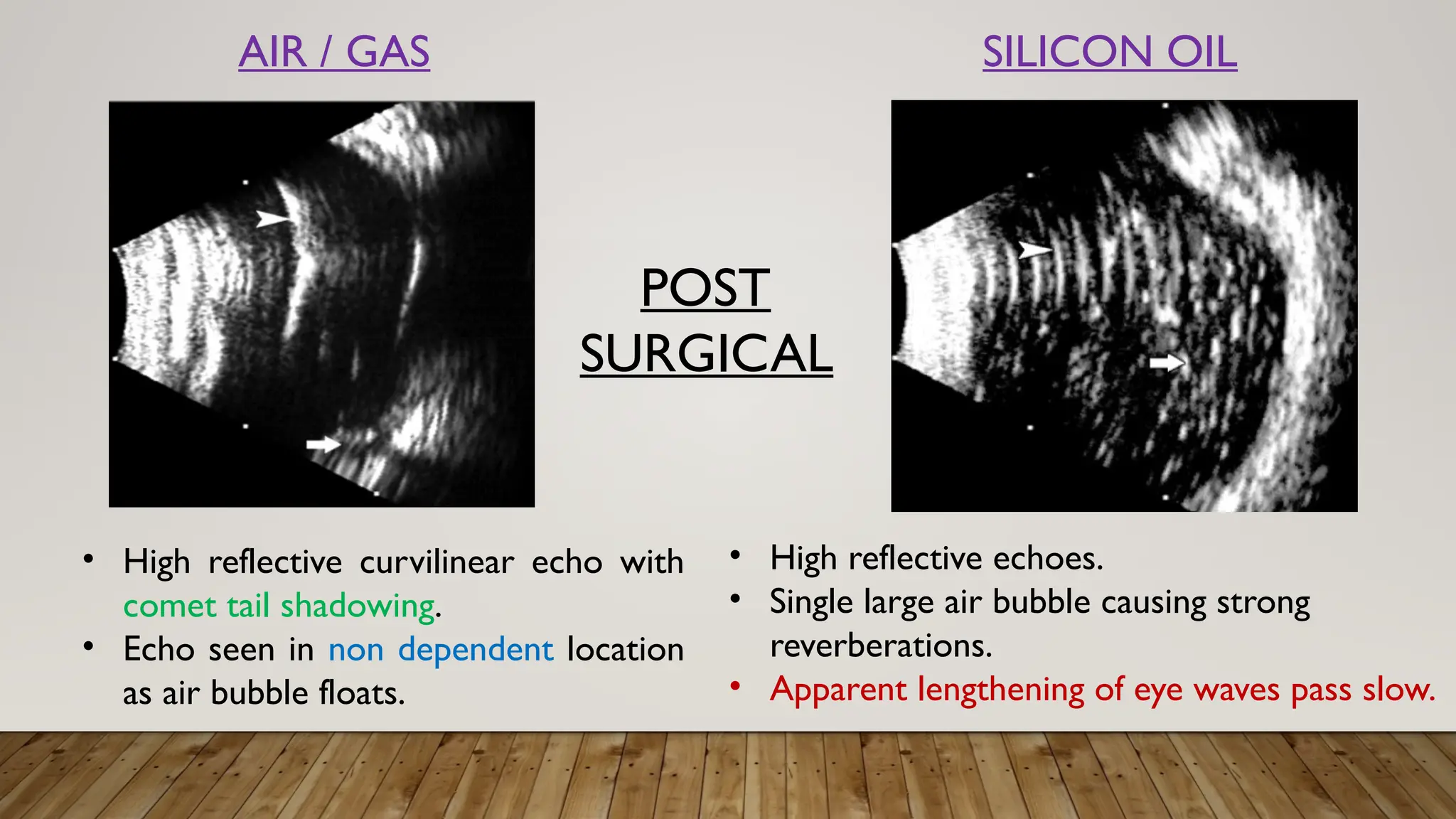 • High reflective curvilinear echo with
comet tail shadowing.
• Echo seen in non dependent location
as air bubble floats.
• High reflective echoes.
• Single large air bubble causing strong
reverberations.
• Apparent lengthening of eye waves pass slow.
AIR / GAS SILICON OIL
POST
SURGICAL
 