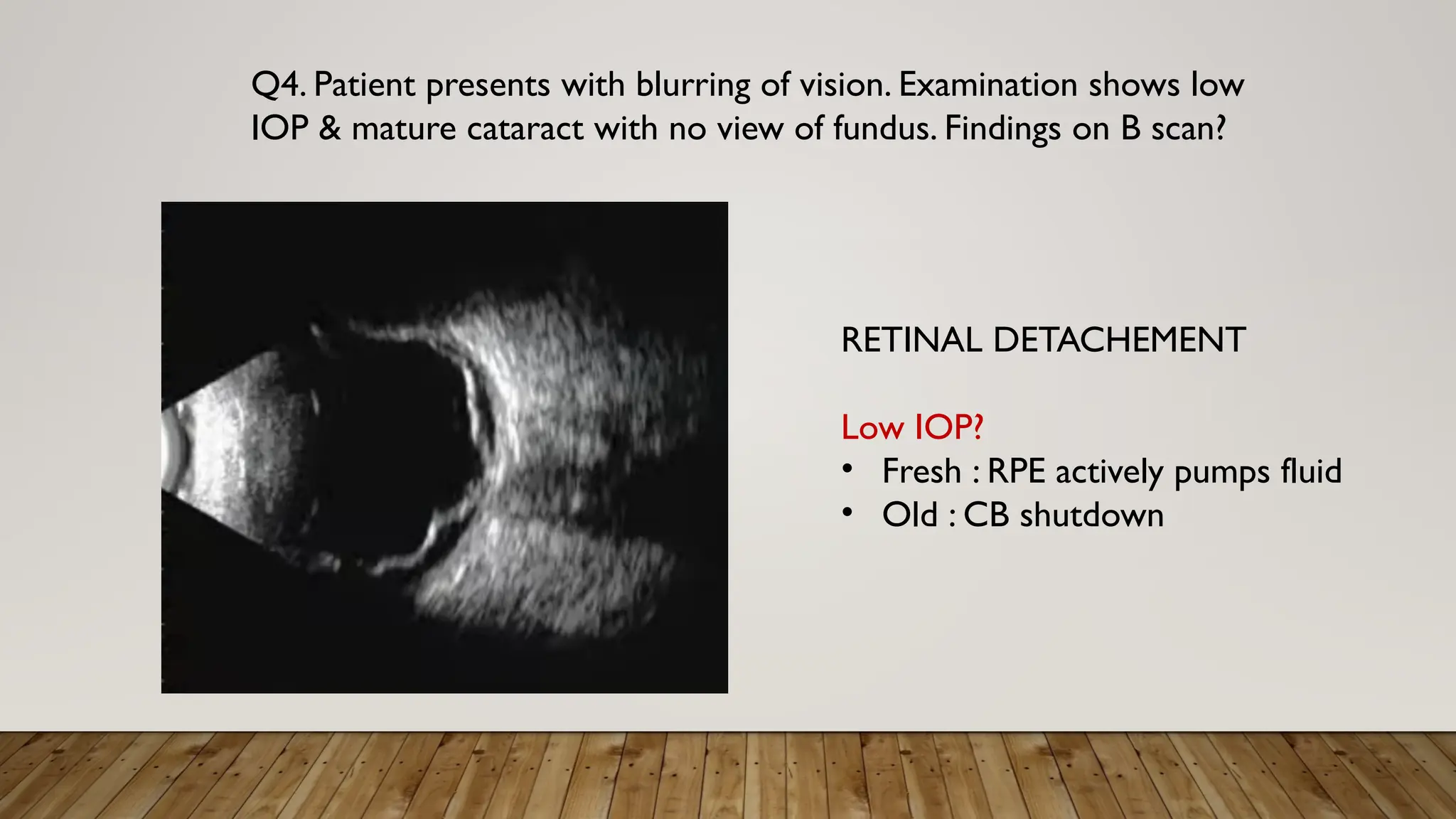 Q4. Patient presents with blurring of vision. Examination shows low
IOP & mature cataract with no view of fundus. Findings on B scan?
RETINAL DETACHEMENT
Low IOP?
• Fresh : RPE actively pumps fluid
• Old : CB shutdown
 