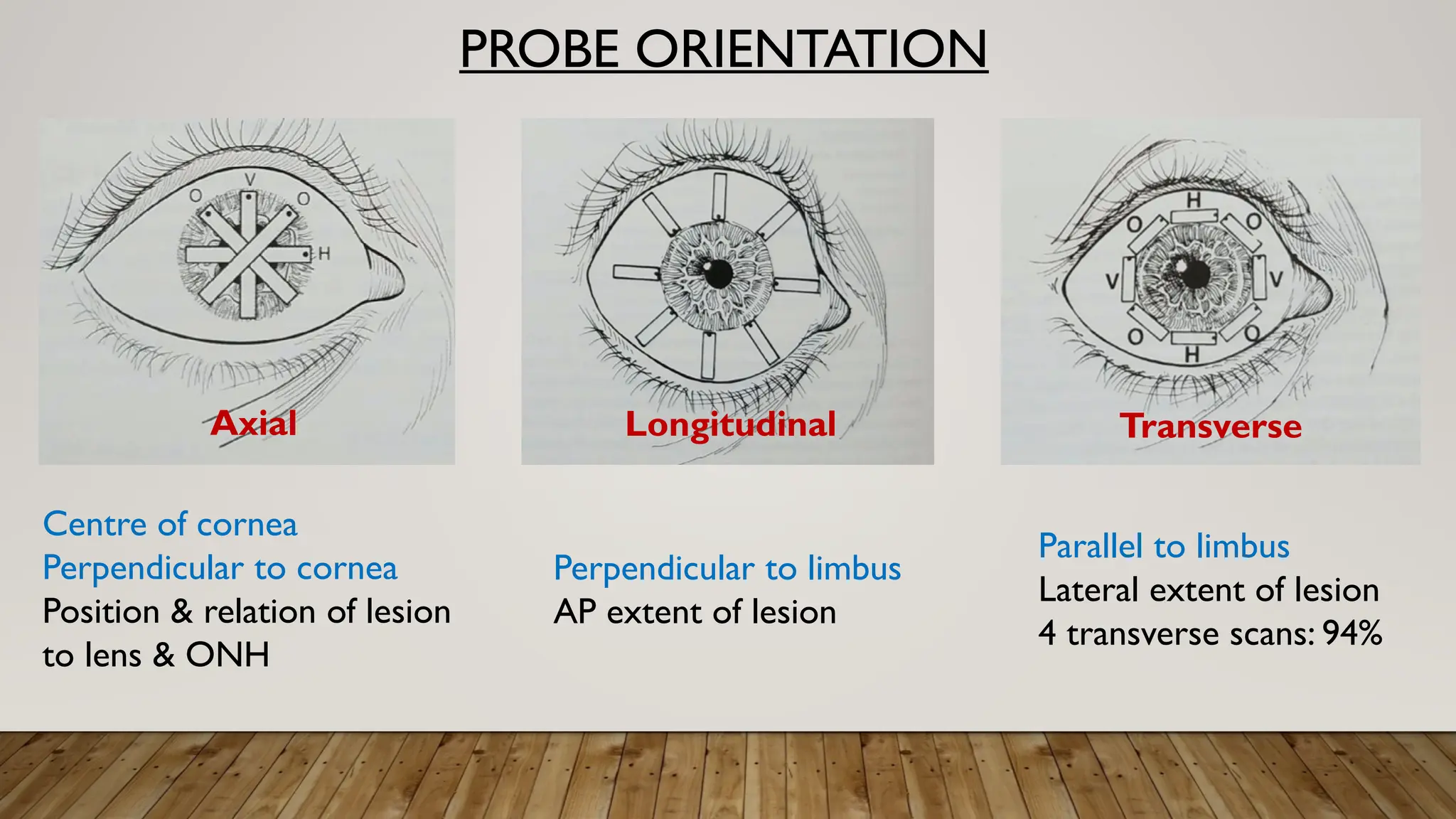 PROBE ORIENTATION
Centre of cornea
Perpendicular to cornea
Position & relation of lesion
to lens & ONH
Axial Longitudinal Transverse
Perpendicular to limbus
AP extent of lesion
Parallel to limbus
Lateral extent of lesion
4 transverse scans: 94%
 