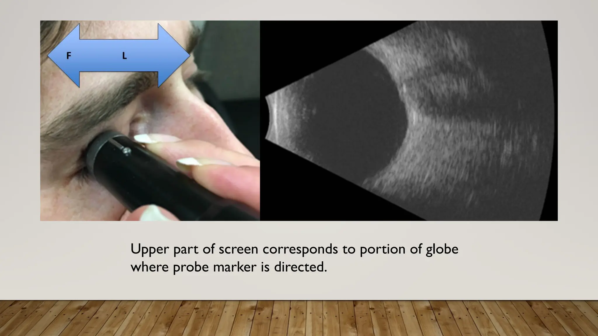 Upper part of screen corresponds to portion of globe
where probe marker is directed.
 