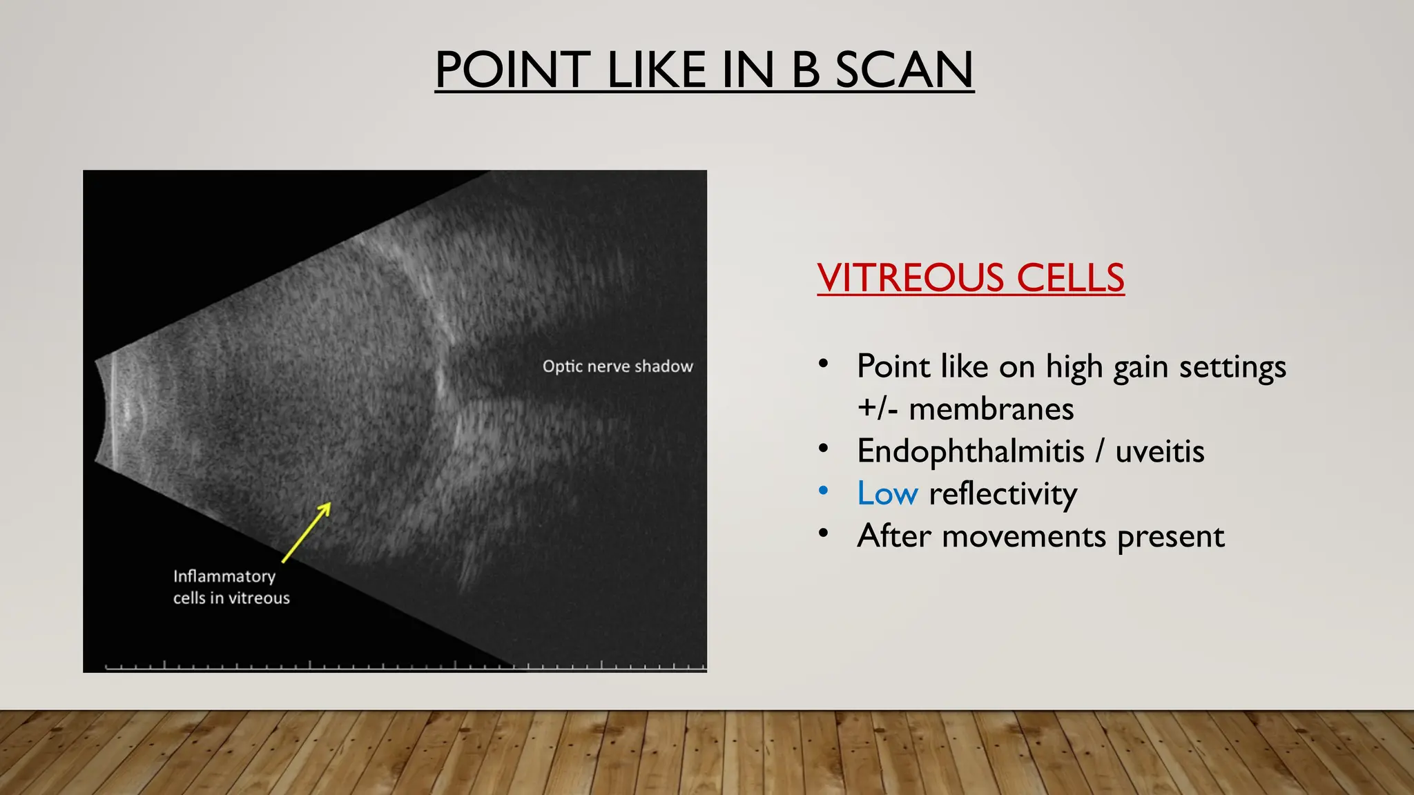 POINT LIKE IN B SCAN
VITREOUS CELLS
• Point like on high gain settings
+/- membranes
• Endophthalmitis / uveitis
• Low reflectivity
• After movements present
 