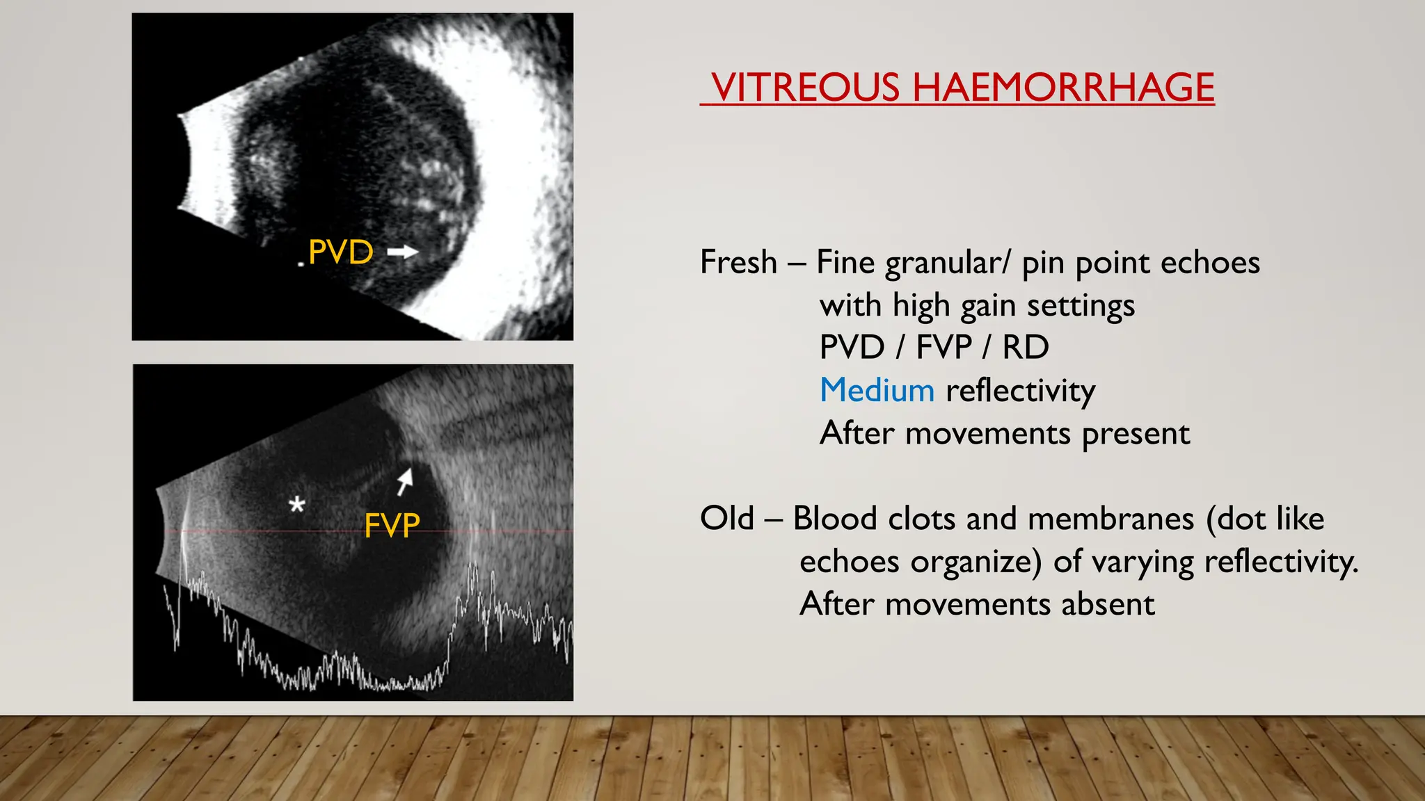 VITREOUS HAEMORRHAGE
Fresh – Fine granular/ pin point echoes
with high gain settings
PVD / FVP / RD
Medium reflectivity
After movements present
Old – Blood clots and membranes (dot like
echoes organize) of varying reflectivity.
After movements absent
PVD
FVP
 