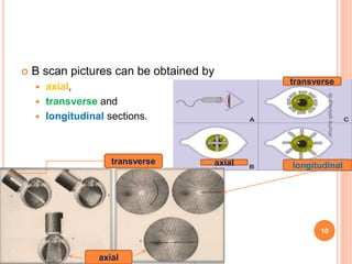  B scan pictures can be obtained by
 axial,
 transverse and
 longitudinal sections.
axial
axial longitudinal
transverse
10
dr
amresh
kumar
transverse
 