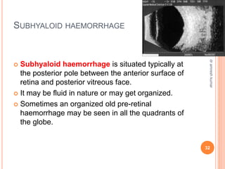 SUBHYALOID HAEMORRHAGE
 Subhyaloid haemorrhage is situated typically at
the posterior pole between the anterior surface of
retina and posterior vitreous face.
 It may be fluid in nature or may get organized.
 Sometimes an organized old pre-retinal
haemorrhage may be seen in all the quadrants of
the globe.
32
dr
amresh
kumar
 
