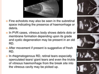  Fine echodots may also be seen in the subretinal
space indicating the presence of haemorrhage or
debris.
 In PVR cases, vitreous body shows debris dots or
membrane formation depending upon its grade
and cystic degeneration may be present in an old
RD.
 After movement if present is suggestive of fresh
RD.
 In rhegmatogenous RD, retinal tears especially
operculated tears/ giant tears and even the trickle
of vitreous haemorrhage from the break site into
the vitreous cavity may be picked up.
39
dr
amresh
kumar
 