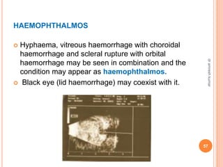 HAEMOPHTHALMOS
 Hyphaema, vitreous haemorrhage with choroidal
haemorrhage and scleral rupture with orbital
haemorrhage may be seen in combination and the
condition may appear as haemophthalmos.
 Black eye (lid haemorrhage) may coexist with it.
57
dr
amresh
kumar
 