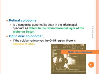  Retinal coloboma
 is a congenital abnormality seen in the inferonasal
quadrant as defect in the retinochoroidal layer of the
globe on Bscan.
 Optic disc coloboma :
 If the coloboma involves the ONH region, there is
absence of ONH.
Optic disc coloboma
64
dr
amresh
kumar
 
