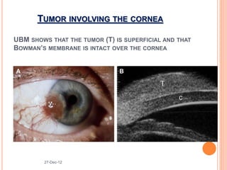 B-SCAN IN OPHTHALMOLOGY.pptx