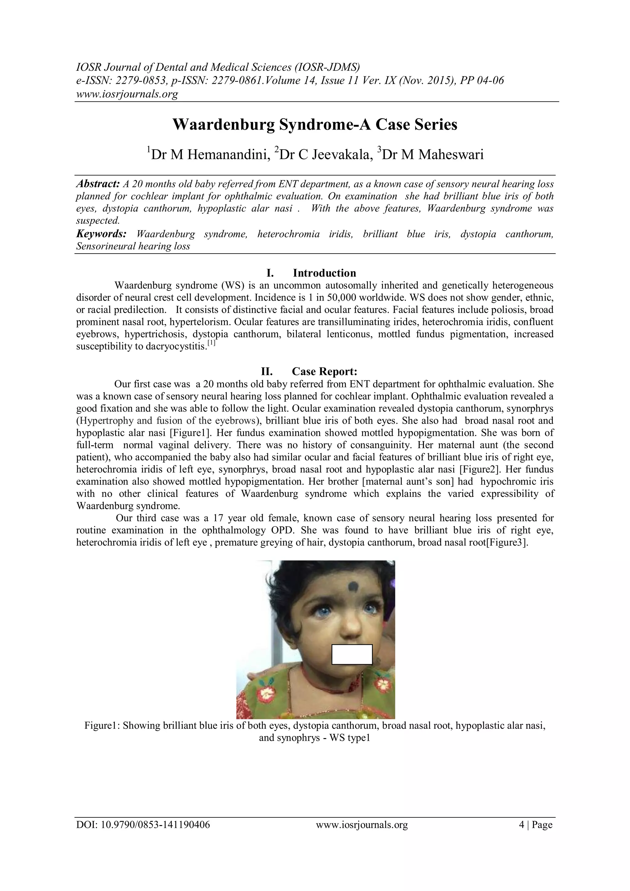Waardenburg Syndrome-A Case Series | PDF