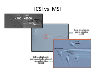 IMSI | PPTX