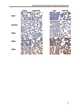 28th International Symposium on Pediatric Surgical Research
22
 