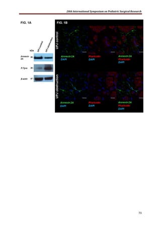 28th International Symposium on Pediatric Surgical Research
73
 