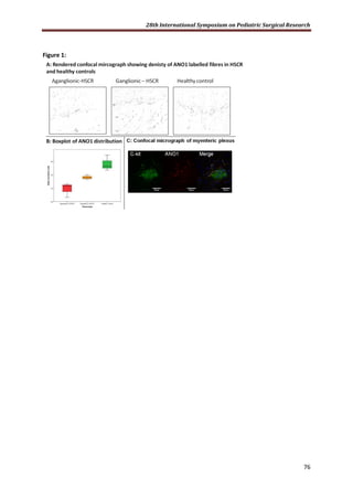 28th International Symposium on Pediatric Surgical Research
76
Figure 1:
 