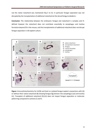 28th International Symposium on Pediatric Surgical Research
8
not the native notochord was maintained (Fig C to G). In particular foregut separation was not
disrupted by the transplantation of additional notochord at the dorsal foregut endoderm.
Conclusion: The relationship between the embryonic foregut and notochord is complex and ill-
defined however the notochord does not contribute essentially to oesophagus and trachea
formation beyond E9 in the mouse, and the transplantation of additional notochord does not disrupt
foregut separation in 3D explant culture.
Figure: Immunohistochemistry for Hnf3b and Sox2 on isolated foregut explant cryosections with (A)
or without their native notochord (B) showing foregut (fg) division into oesophagus (oe) and trachea
(tr). Transplant of additional notochord (D,E,G) does not impact foregut separation or molecular
patterning compared to controls (C and F).
 