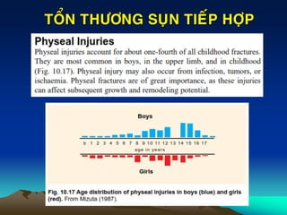 TOÅN THÖÔNG SUÏN TIEÁP HÔÏP
 