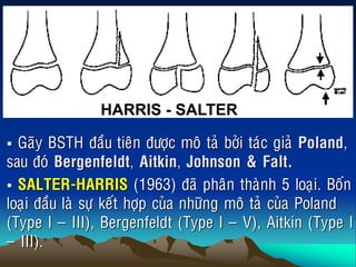  Gaõy BSTH ñaàu tieân ñöôïc moâ taû bôûi taùc giaû Poland,
sau ñoù Bergenfeldt, Aitkin, Johnson & Falt.
 SALTER-HARRIS (1963) ñaõ phaân thaønh 5 loaïi. Boán
loaïi ñaàu laø söï keát hôïp cuûa nhöõng moâ taû cuûa Poland
(Type I ‟ III), Bergenfeldt (Type I ‟ V), Aitkin (Type I
‟ III).
HARRIS - SALTER
 