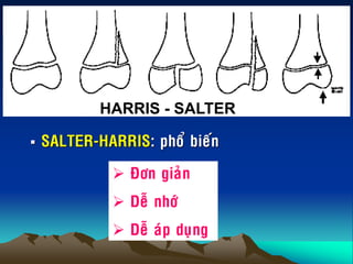  SALTER-HARRIS: phoå bieán
HARRIS - SALTER
 Ñôn giaûn
 Deã nhôù
 Deã aùp duïng
 