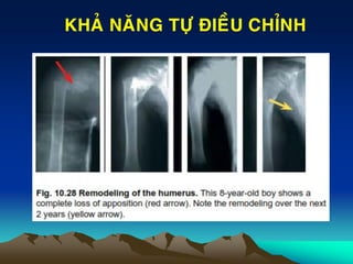 KHAÛ NAÊNG TÖÏ ÑIEÀU CHÆNH
 