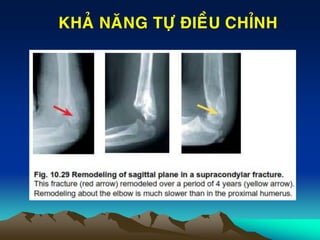 KHAÛ NAÊNG TÖÏ ÑIEÀU CHÆNH
 