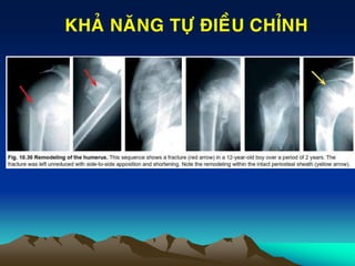 KHAÛ NAÊNG TÖÏ ÑIEÀU CHÆNH
 