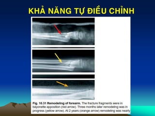 KHAÛ NAÊNG TÖÏ ÑIEÀU CHÆNH
 