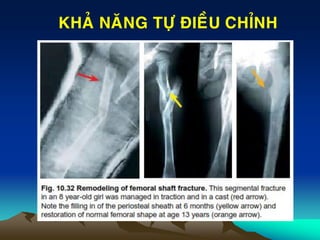 KHAÛ NAÊNG TÖÏ ÑIEÀU CHÆNH
 