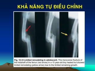 KHAÛ NAÊNG TÖÏ ÑIEÀU CHÆNH
 