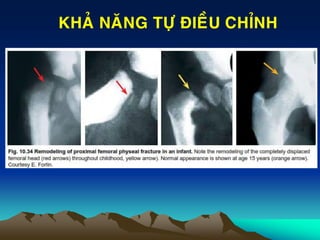 KHAÛ NAÊNG TÖÏ ÑIEÀU CHÆNH
 