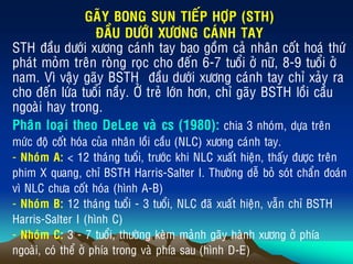 GAÕY BONG SUÏN TIEÁP HÔÏP (STH)
ÑAÀU DÖÔÙI XÖÔNG CAÙNH TAY
STH ñaàu döôùi xöông caùnh tay bao goàm caû nhaân coát hoaù thöù
phaùt moûm treân roøng roïc cho ñeán 6-7 tuoåi ôû nöõ, 8-9 tuoåi ôû
nam. Vì vaäy gaõy BSTH ñaàu döôùi xöông caùnh tay chæ xaûy ra
cho ñeán löùa tuoåi naày. ÔÛ treû lôùn hôn, chæ gaõy BSTH loài caàu
ngoaøi hay trong.
Phaân loaïi theo DeLee vaø cs (1980): chia 3 nhoùm, döïa treân
möùc ñoä coát hoùa cuûa nhaân loài caàu (NLC) xöông caùnh tay.
- Nhoùm A: < 12 thaùng tuoåi, tröôùc khi NLC xuaát hieän, thaáy ñöôïc treân
phim X quang, chæ BSTH Harris-Salter I. Thöôøng deã boû soùt chaån ñoaùn
vì NLC chöa coát hoùa (hình A-B)
- Nhoùm B: 12 thaùng tuoåi - 3 tuoåi, NLC ñaõ xuaát hieän, vaãn chæ BSTH
Harris-Salter I (hình C)
- Nhoùm C: 3 - 7 tuoåi, thöôøng keøm maûnh gaõy haønh xöông ôû phía
ngoaøi, coù theå ôû phía trong vaø phía sau (hình D-E)
 