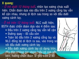 X quang:
- ÔÛ treû döôùi 12 thaùng tuoåi, nhaân taïo xöông chöa xuaát
hieän. Chaån ñoaùn döïa vaøo ñaàu treân 2 xöông caúng tay vaãn
keà caän nhau, nhöng di leäch sau trong so vôùi ñaàu döôùi
xöông caùnh tay.
- ÔÛ treû treân 12 thaùng tuoåi, NLC xuaát hieän,
BSTH ñöôïc chaån ñoaùn döïa vaøo 4 ñieåm sau:
 Ñaàu treân 2 xöông caúng tay vaãn keà caän
 Ñöôøng quay - loài caàu coøn
 Toaøn boä ñaàu treân 2 xöông caúng tay vaø
NLC ñoàng boä di leäch ra sau, vaøo trong so
vôùi ñaàu döôùi xöông caùnh tay
 Ñaàu döôùi xöông caùnh tay coù daïng troøn,
ñeàu ñaën khoâng gai nhoïn (neáu coù cöïa saét
beùn, höôùng chaån ñoaùn laø gaõy treân 2 loài
 