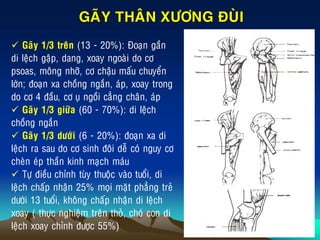 GAÕY THAÂN XÖÔNG ÑUØI
 Gaõy 1/3 treân (13 - 20%): Ñoaïn gaàn
di leäch gaäp, dang, xoay ngoaøi do cô
psoas, moâng nhôõ, cô chaäu maáu chuyeån
lôùn; ñoaïn xa choàng ngaén, aùp, xoay trong
do cô 4 ñaàu, cô uï ngoài caúng chaân, aùp
 Gaõy 1/3 giöõa (60 - 70%): di leäch
choàng ngaén
 Gaõy 1/3 döôùi (6 - 20%): ñoaïn xa di
leäch ra sau do cô sinh ñoâi deã coù nguy cô
cheøn eùp thaàn kinh maïch maùu
 Töï ñieàu chænh tuøy thuoäc vaøo tuoåi, di
leäch chaáp nhaän 25% moïi maët phaúng treû
döôùi 13 tuoåi, khoâng chaáp nhaän di leäch
xoay ( thöïc nghieäm treân thoû, choù con di
leäch xoay chænh ñöôïc 55%)
 