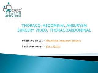 Thoraco-Abdominal Aneurysm Surgery Video, Thoracoabdominal Please log on to : - Abdominal Aneurysm Surgery Send your query : - Get a Quote 