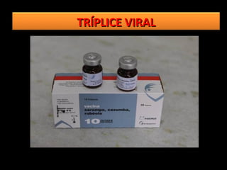TRÍPLICE VIRAL
 