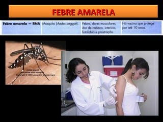 FEBRE AMARELA
 
