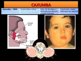 CAXUMBA
 