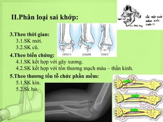 II.Phân loại sai khớp:
3.Theo thời gian:
3.1.SK mới.
3.2.SK cũ.
4.Theo biến chứng:
4.1.SK kết hợp với gãy xương.
4.2.SK kết hợp với tổn thương mạch máu – thần kinh.
5.Theo thương tổn tỗ chức phần mềm:
5.1.SK kín.
5.2.Sk hở.

 