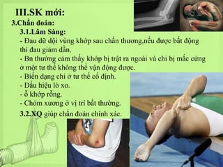 III.SK mới:
3.Chẩn đoán:
3.1.Lâm Sàng:
- Đau dữ dội vùng khớp sau chấn thương,nếu được bất động
thì đau giảm dần.
- Bn thường cảm thấy khớp bị trật ra ngoài và chi bị mắc cứng
ở một tư thế không thể vận động được.
- Biến dạng chi ở tư thế cố định.
- Dấu hiệu lò xo.
- ỗ khớp rỗng.
- Chỏm xương ở vị trí bất thường.
3.2.XQ giúp chẩn đoán chính xác.

 