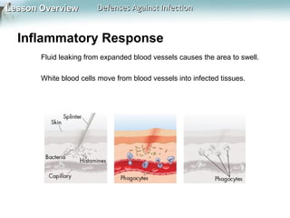Lesson Overview

Defenses Against Infection

Inflammatory Response
Fluid leaking from expanded blood vessels causes the area to swell.
White blood cells move from blood vessels into infected tissues.

 